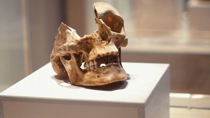 Un teschio esposto su un semplice piedistallo, con dettagli anatomici e storici chiaramente visibili.